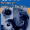 Color Atlas Of Melanocytic Lesions Of The Skin