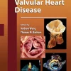 Valvular Heart Disease