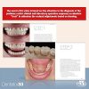 3STEP Additive Prosthodontics RS - Image 3