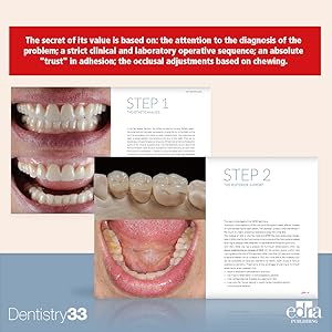 3STEP Additive Prosthodontics RS - Image 3