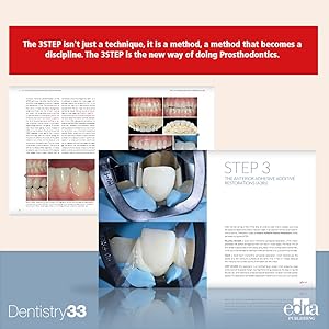 3STEP Additive Prosthodontics RS - Image 4