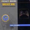 Specialty Imaging: Breast Mri